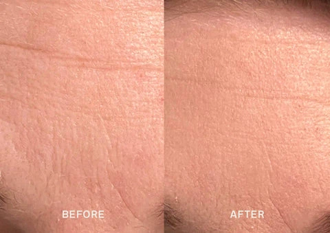 Before and After Face Taping Before and After Face Taping